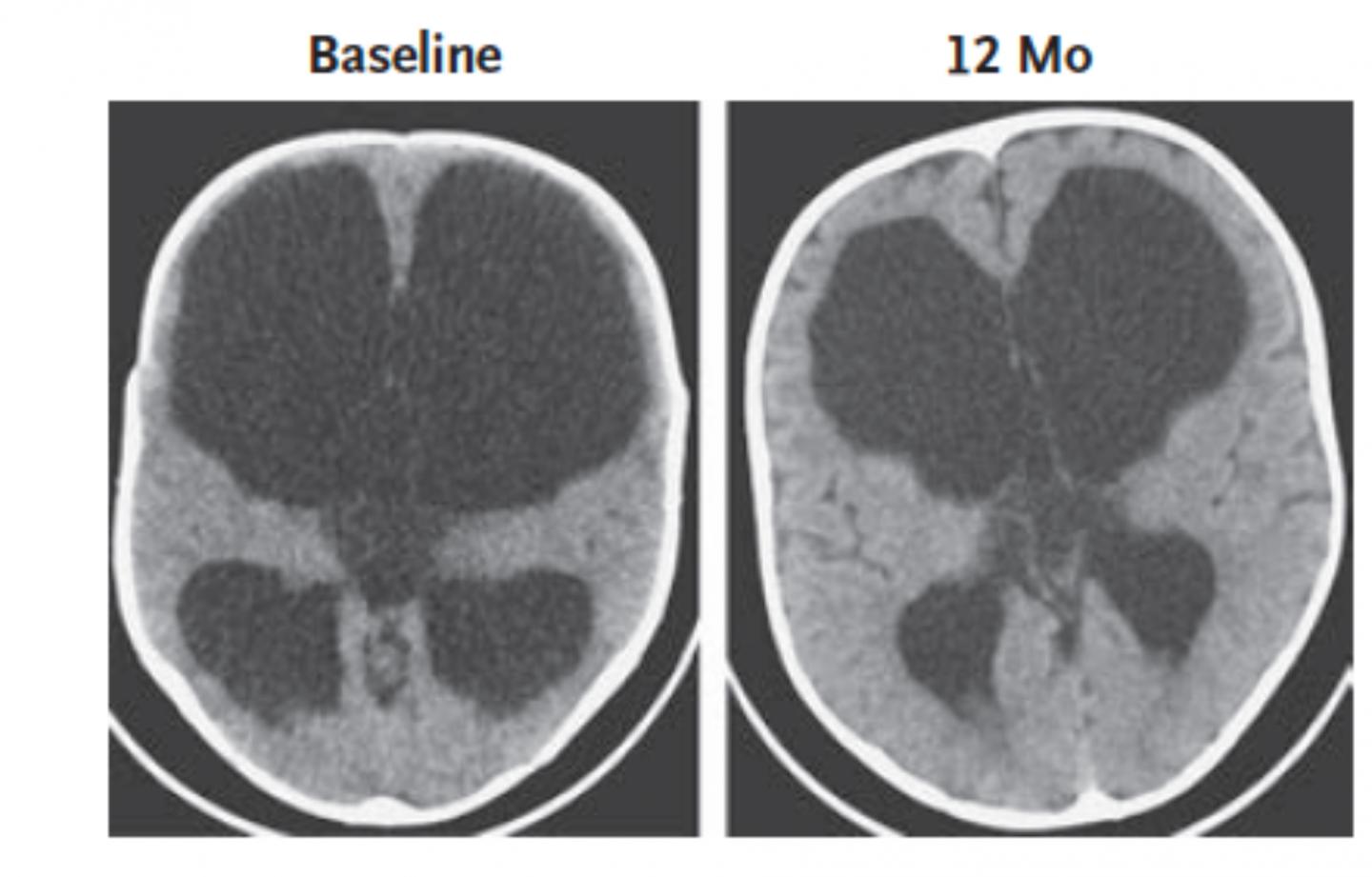 Brain Image