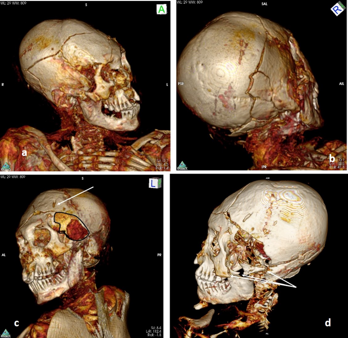 Skull