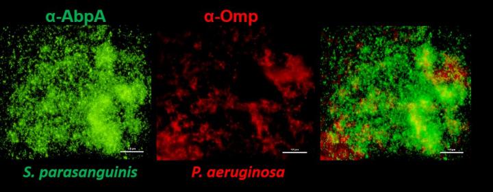 Scientists Uncover Interactions Between Bacteria that Infect the Lungs in Cystic Fibrosis