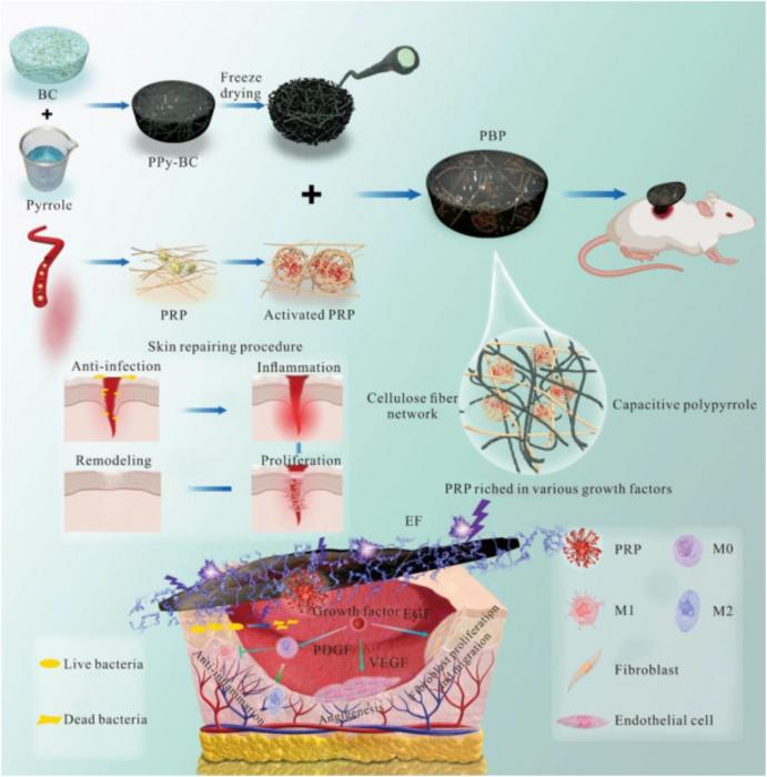 Smart Hydrogel Mimics Skin Repair to Accelerate Diabetic Wound Healing