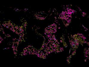 Bone marrow map