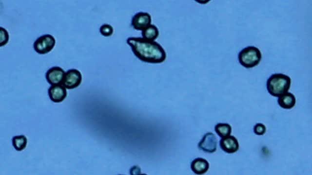Cheryl-Ingram Smith and <em>Entamoeba histolytica</em>