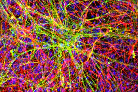 Healthy iPSC-derived Motor Neurons, Yeo lab, UC San Diego School of Medicine