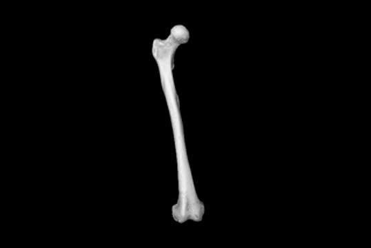 CT Scanning the Femoral Head of Farmers and Foragers to Show Bone Mass and Fragility
