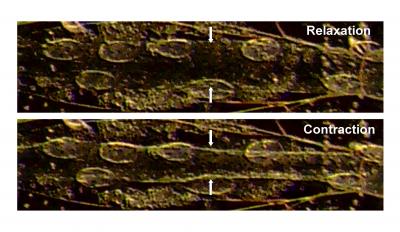 Drosophila Heart Muscle