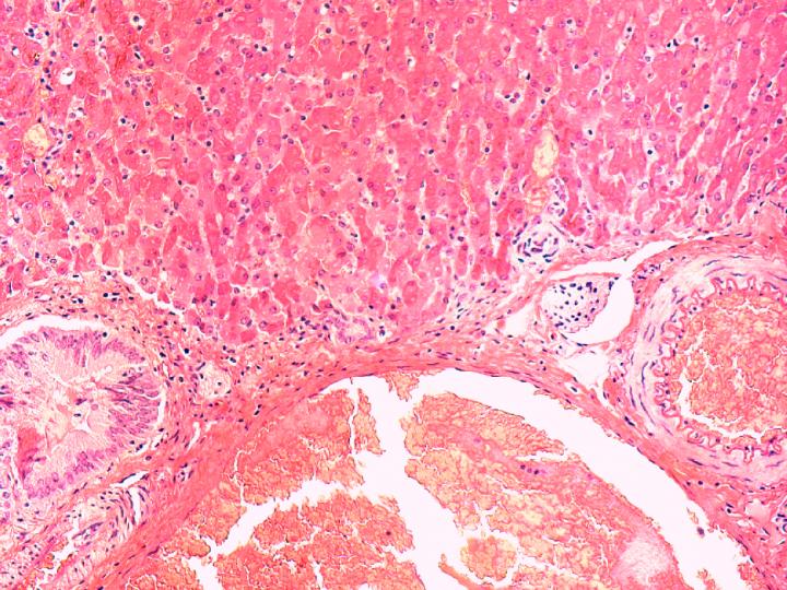Seal Liver Infected with Hepatitis A-Like Virus (1 of 2)