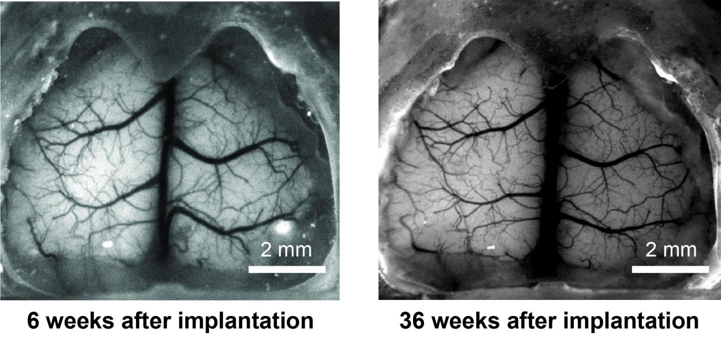 Mouse Brain