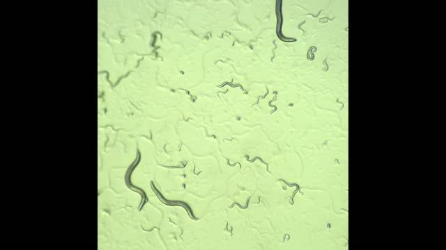 DÃ©couverte d'un mÃ©dicament prometteur pour la sclÃ©rose latÃ©rale amyotrophique