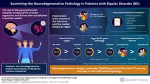 Neurodegenerative pathology of bipolar disorder