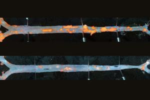 Immunotherapy reduces plaque in arteries of mice