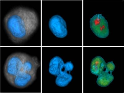3-D Cancer Cells