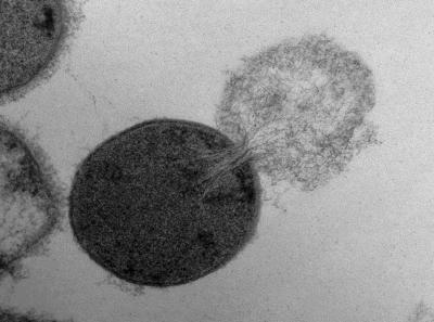 Cell Experiencing Lysis (1 of 2)