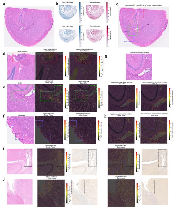 图2 基因表达空间分布对比（真实 vs 预测） 显示模型对关键基因空间模式的准确预测