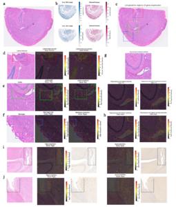 Fig 2 Spatial gene expression (real vs predicted) Validation of gene pattern accuracy