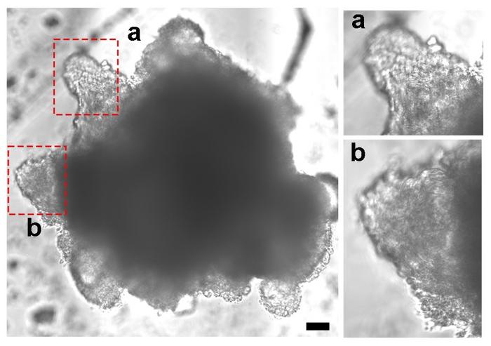 Heart assembloid and valves