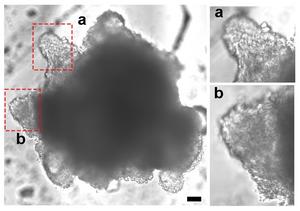 Heart assembloids give researchers a new way to study heart valve disorders