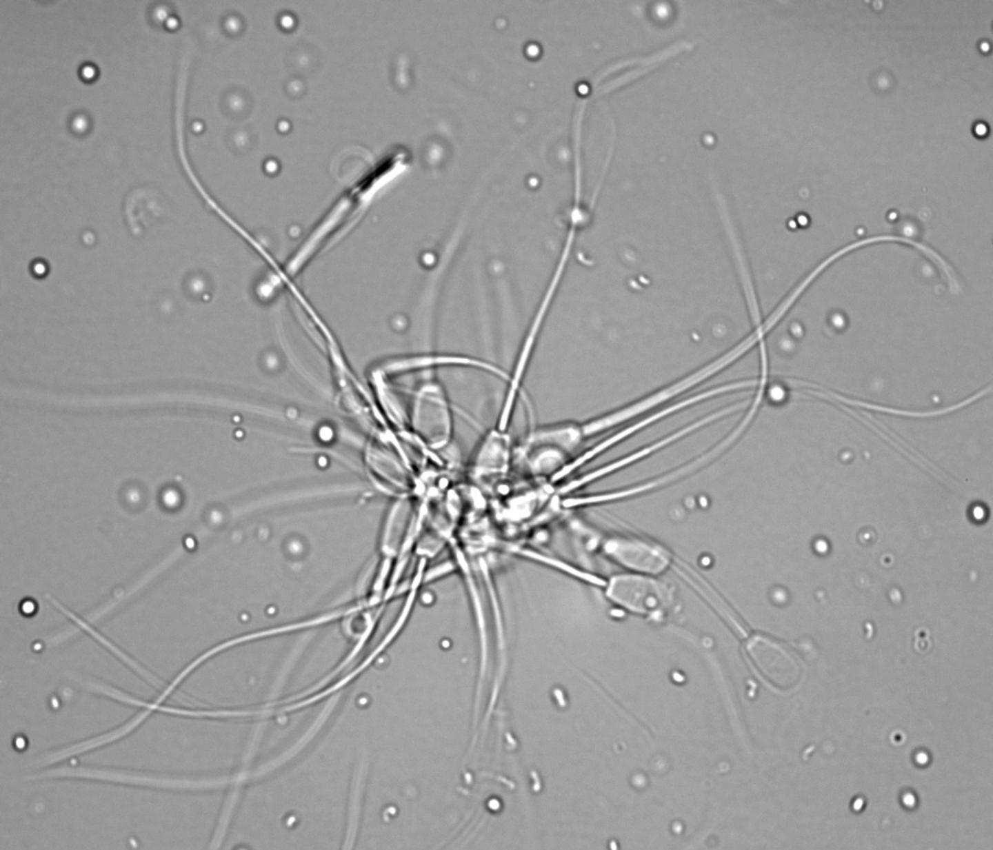 Bovine Sperm