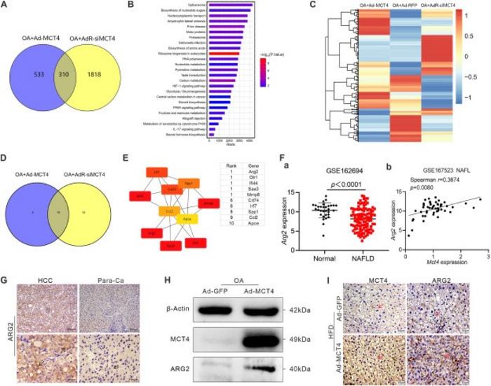 MCT4 regulates hub genes interactions to influence hepatic lipid metabolism.