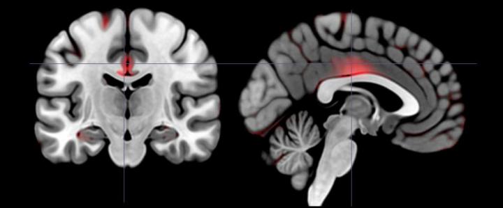 Volume of the Brain