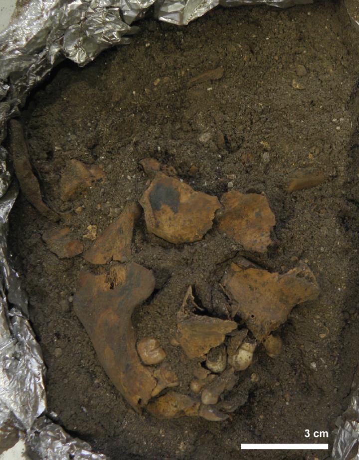 Fragmented mandible and cranial vault. The temporo-mandibular joint appears articulated