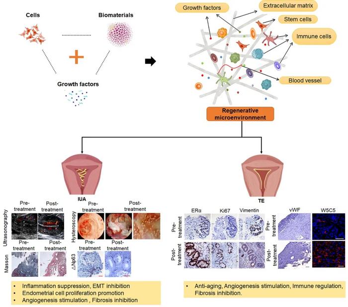 Figure 3. Regenerative medicine for the treatment of IUA and TE by improving the endometrial microenvironment.