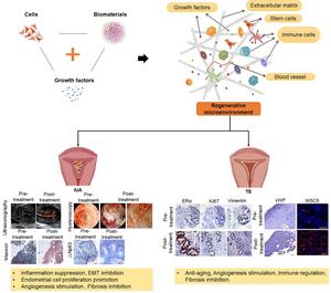Figure 3. Regenerative medicine for the treatment of IUA and TE by improving the endometrial microenvironment.