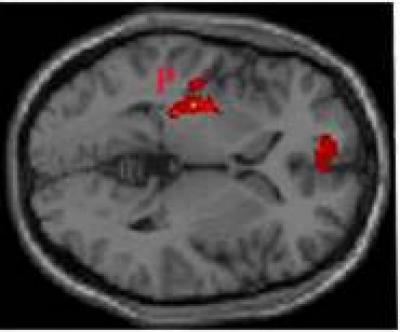 Brain Activation