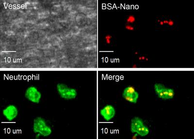 Nanoparticles