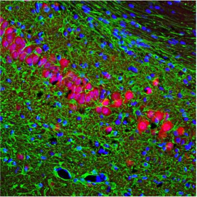 Nerve Cells Dying in the Brain of Prion-Diseased Mice