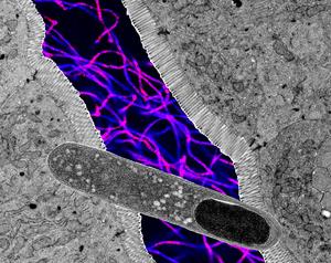 Turicibacter graphic