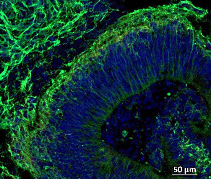 while cell nuclei are shown in blue (DAPI)