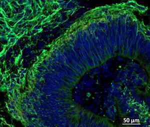 while cell nuclei are shown in blue (DAPI)