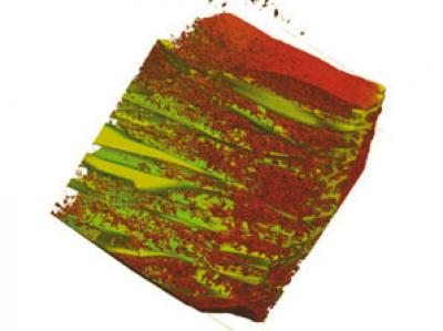 Cells in  Scaffold