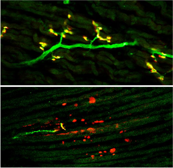 Loss of Tiny 'Non-Coding' Genetic Molecules Could Play Role in Neurodegenerative Diseases