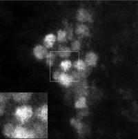 Ferritin Finger