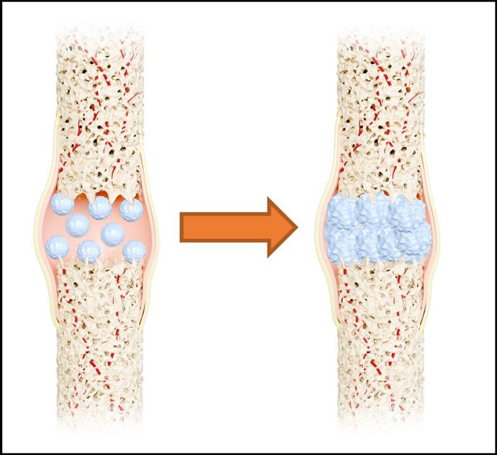nano-artificial bone material