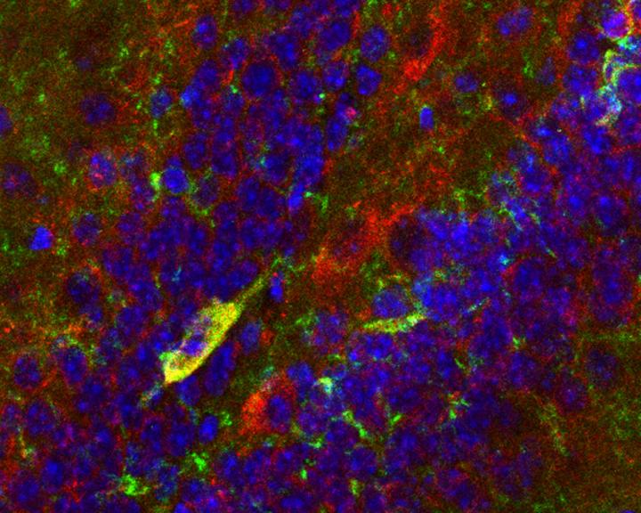 SSRI Targets