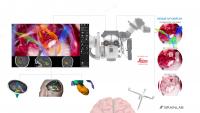 Microscope Imaging System