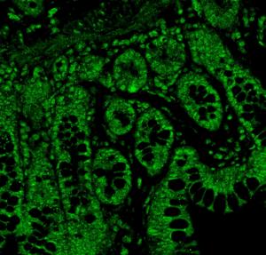 Serotonin receptors in the gut increase after low-dose THC treatment