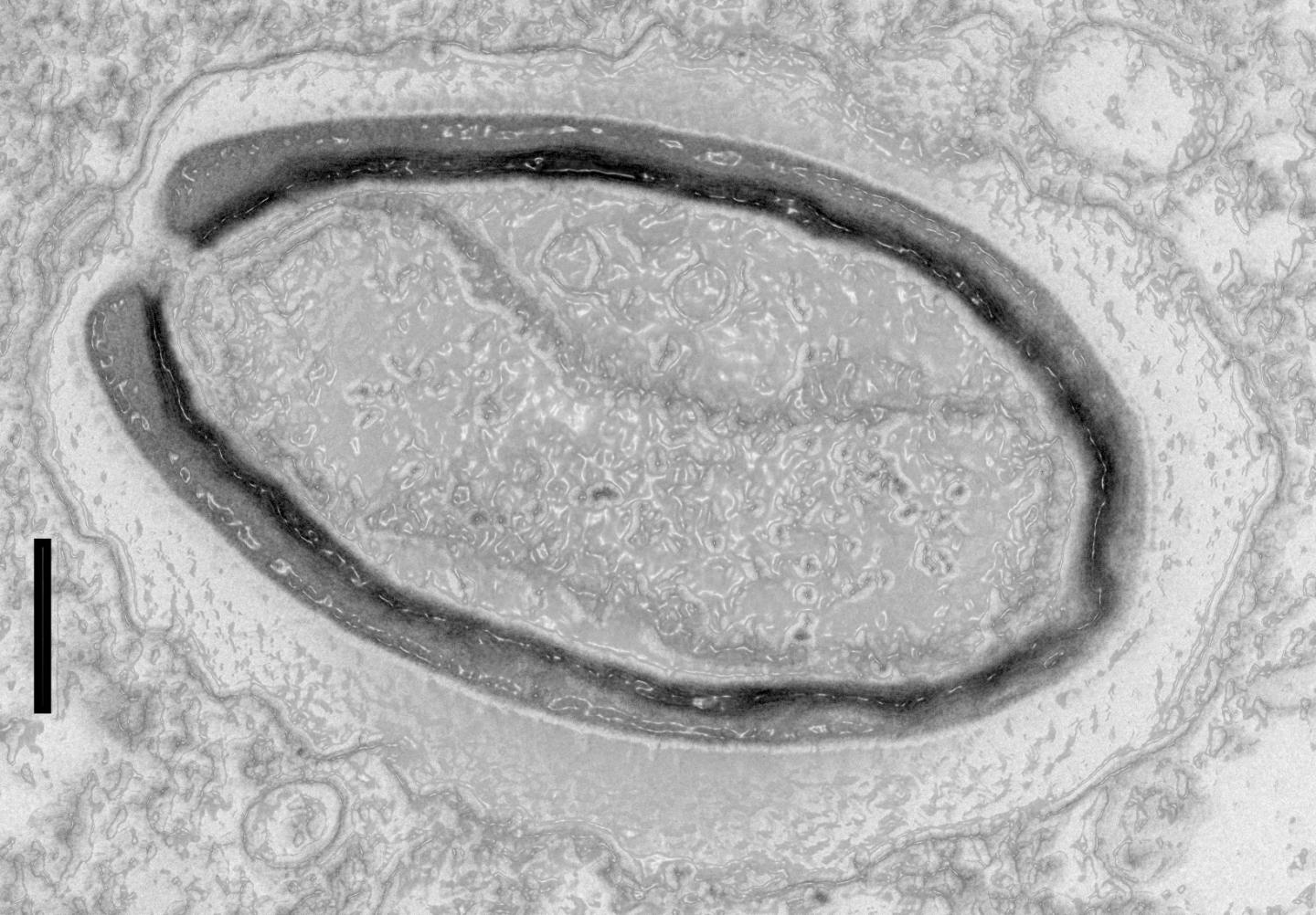 <i>Pandoravirus quercus</i>