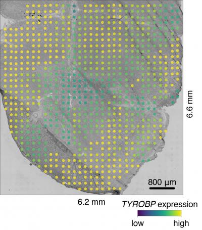 TYROBP Expression