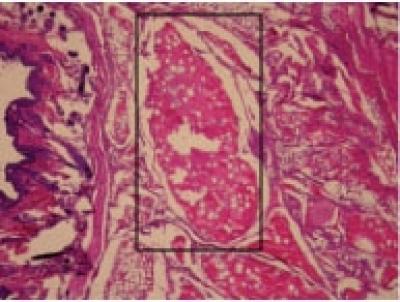 Bone from Blood