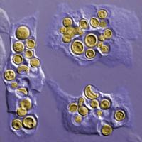 <i>Cryptococcus gatti</i>