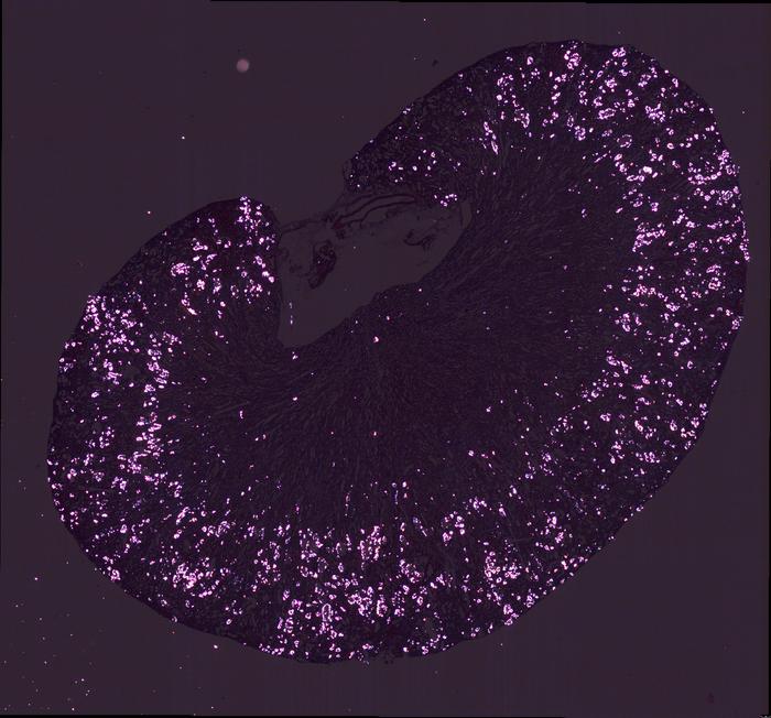 Oxalate in kidney cortex