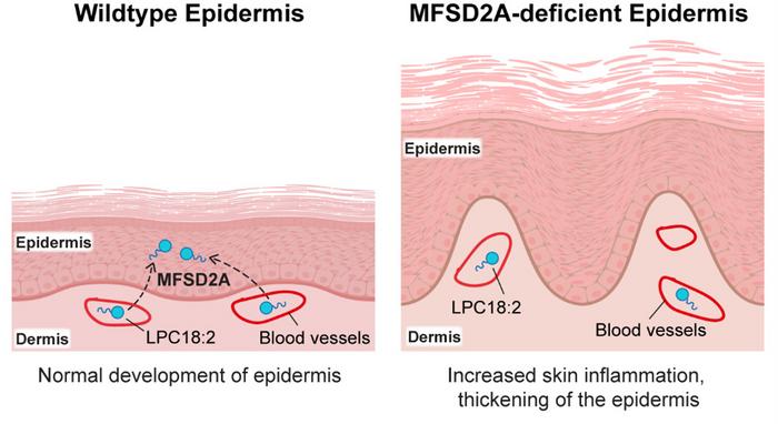 MFSD2A lipid transporter