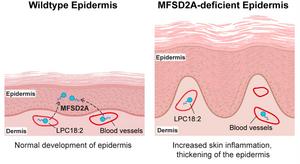 MFSD2A lipid transporter
