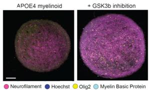 Improved axon growth