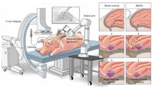 Schematic showing the intracranial delivery of the BBHFs under the combined system of magnetic actuation unit and fluoroscopy