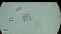 Dinoflagellates and <i>Choanoeca flexa</i>