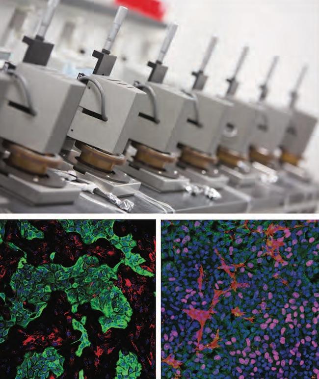 Pioneering New 3D Cancer Model to Speed New Treatments